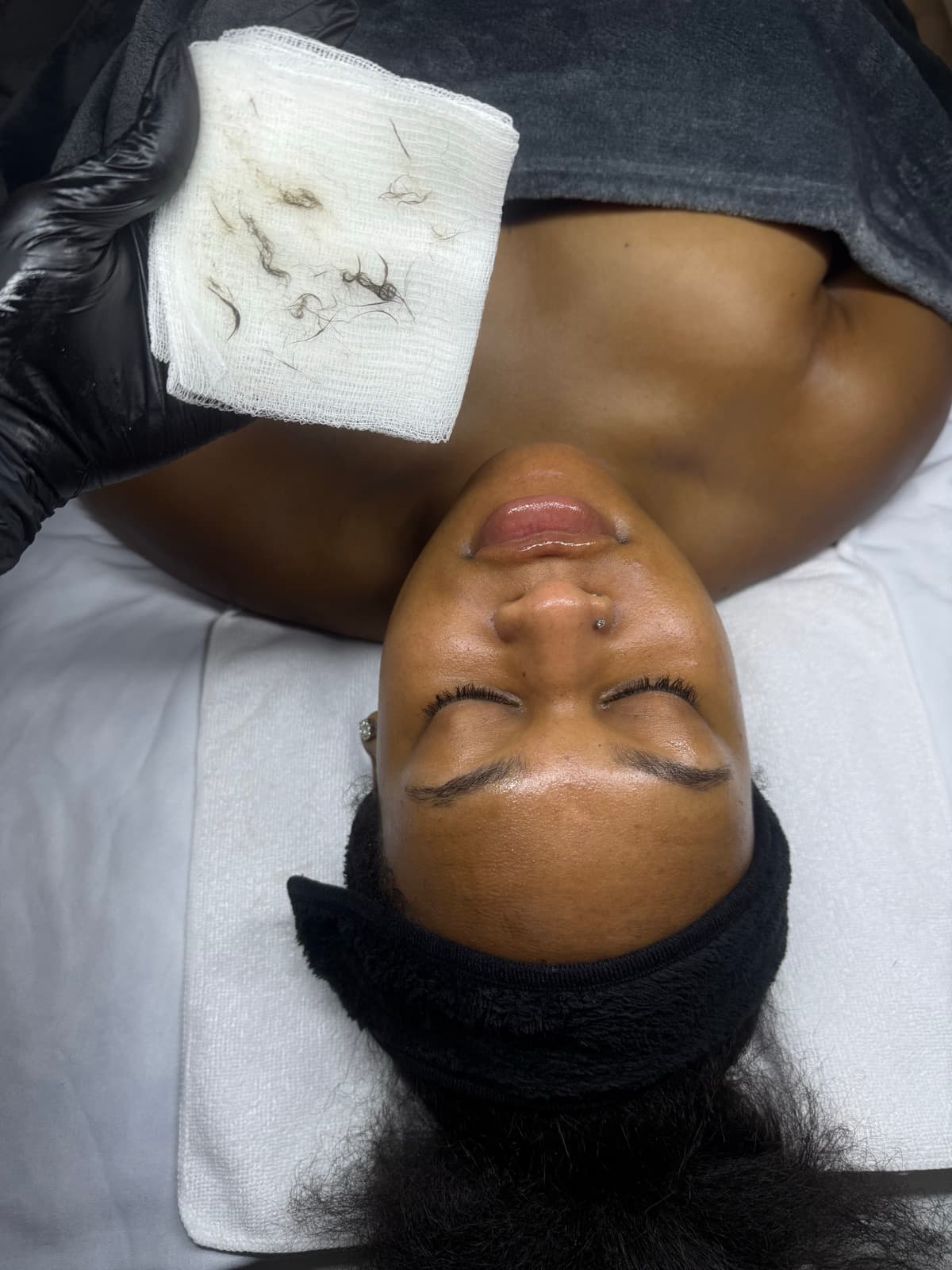 Corrective Facials